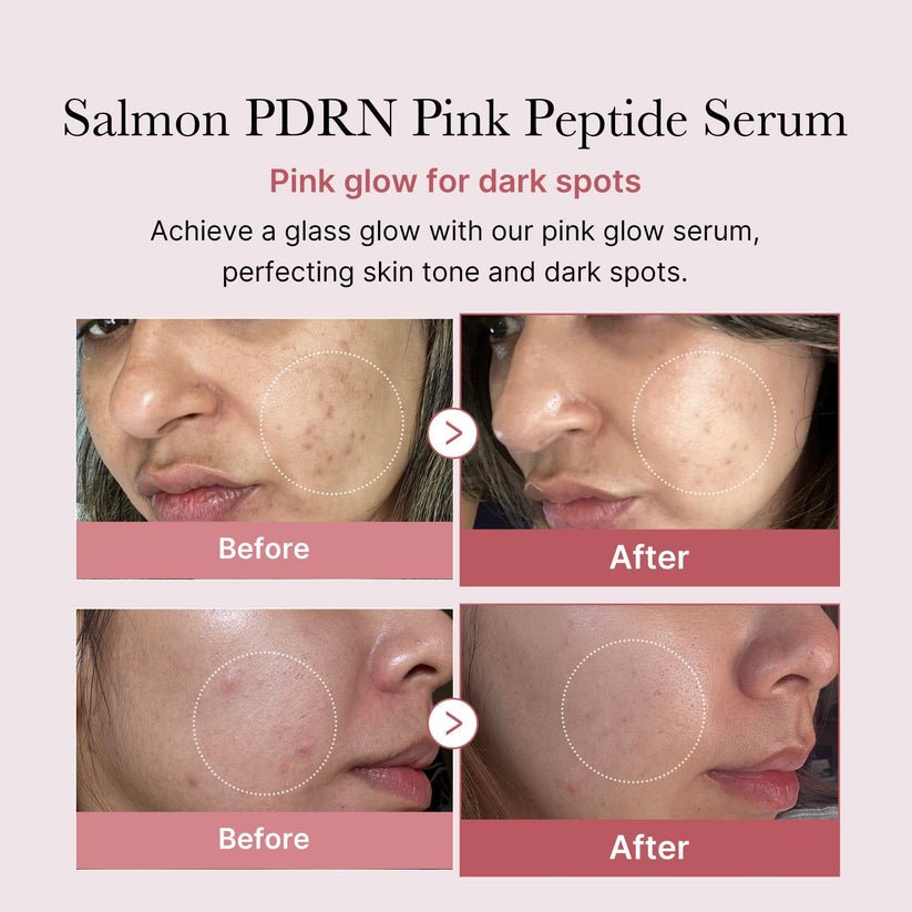 Medicube PDRN Pink Peptide Brightening Glow Serum 30ml - Collagen Hydrating & Firming Essence for Radiant Skin | Moisturizing Anti Dullness Facial Serum - PSEUDO LABS