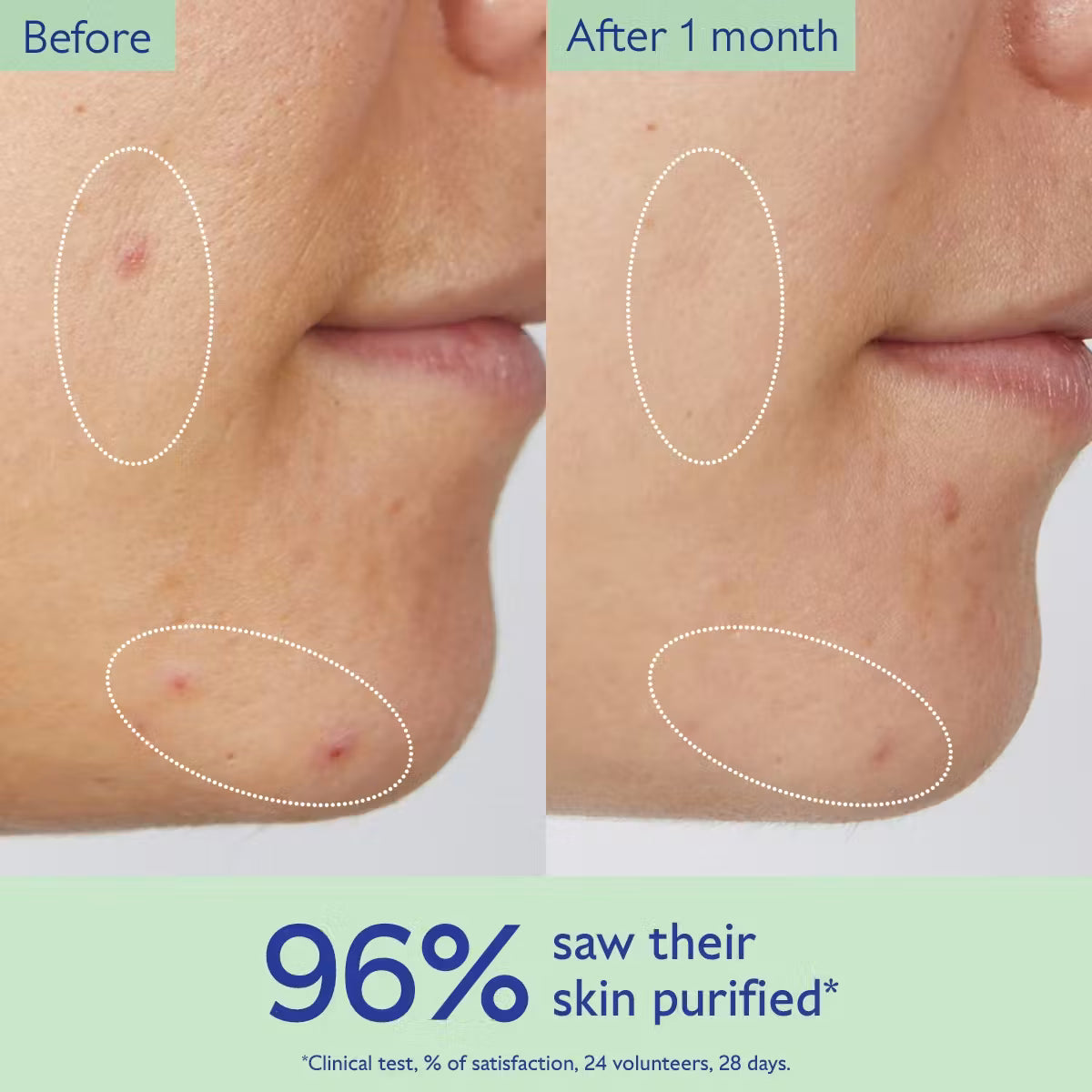 Caudalie Vinopure Purifying Cleansing Gel - Natural Acne Treatment &amp; Antioxidant Skincare